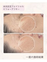 ティアラ(Tiara)/