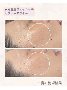 ティアラ(Tiara)/