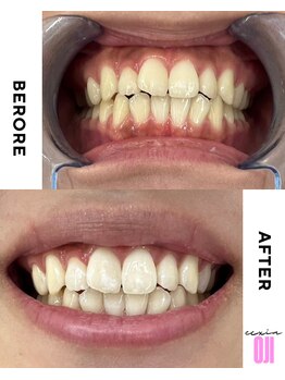 エクシアホワイトニング 王寺店/