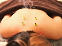 ロミアオ(Lomi-AO)の雰囲気（あたたか～いお灸と優しくツボを刺激するはりで肩こりもスッキリ）