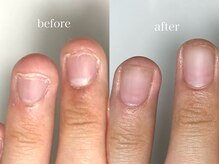 フェミニンネイル(Feminine Nail)