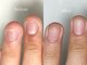 フェミニンネイル(Feminine Nail)の写真