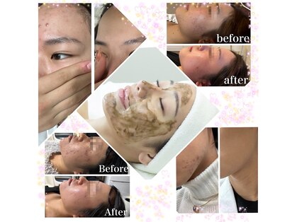 サクラベル(sakura belle)の写真