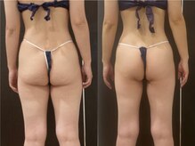 ソイズ 上中居店(SOIS)/インド痩身