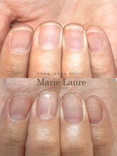 マリーロール 淀屋橋本店(Marie Laure)/自爪育成/深爪矯正/ネイルケア