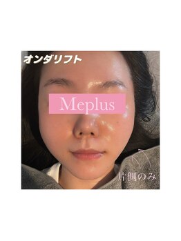 ミープラス(Me+)/小顔マイクロ波リフト