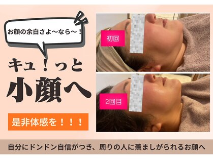 フォーエリミスプラス(for elims+)の写真