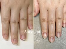 アーティネイルズ(Aaty Nails)/【美爪キープコース】ハンド