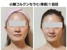 【圧倒的小顔】小顔コルギ＋背中+ヘッド110分☆たるみ・むくみ改善◎