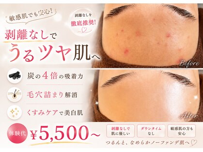 ナトゥーラ チュチュ(natura chuchu)の写真