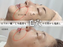 シャルトルズ 西宮北口店の雰囲気（ほうれい線・シミ改善は洗浄だけでは改善しません）