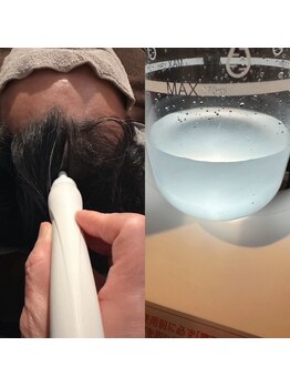 マーブルリング(marblering)の写真/お顔までリフトアップする極上ヘッドスパ◎追加メニューの水素水毛穴洗浄を行うことで頭皮の汚れも解消♪