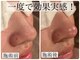 ビーフリー(Be free)の写真