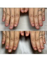 ラミーネイル(Ramie nail)/自爪育成ケアコース