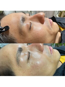 ティグレ 岡山店(TIGRE)/ハリウッドブロウリフト(眉毛)