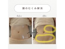 カルム(calme)の雰囲気（腸の不調は体の不調。便秘、むくみ等でお悩みの方オススメです。）