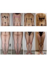 クーラ テュセ(Coeur la Tusais)/全身まるごと痩身