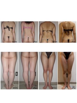 クーラ テュセ(Coeur la Tusais)/全身まるごと痩身