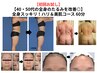 【初回お試し】40・50代全身のたるみを改善!全身のたるみを改善face&body60分