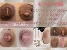 ルミエール(Lumiere)