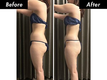 ザ ウィンバックサロン(THE WINBACK SALON)/ウエスト幅・ヒップの位置に変化