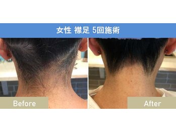 シャイン(SHINE)/