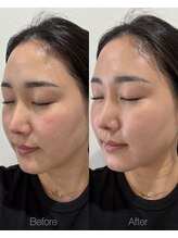 彌庵/当店大人気リカバリーバーム