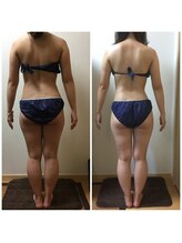 ロータス(Lotus)/30代　(左)ビフォー(右)アフター