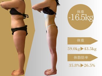マルレ(MARLE)の写真/本気で10kg減量を目指す！全身痩身【痩身マシン3種体験！どっ汗スリム★プログラム】大幅減量成功者続出◎