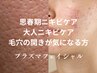 【ニキビケア＆開き毛穴ケア】プラズマフェイシャル（滞在時間30分以内です）