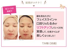 ファニービー 茨木店/Before→After