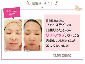 ファニービー 茨木店/Before→After