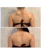 サロン リノ(Salon Lino)/痩身エステ