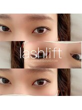 エル 薬院店(Eru)/お目元ぱっちり！