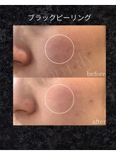 アノマリー 六本松店(Anomaly)/before → after