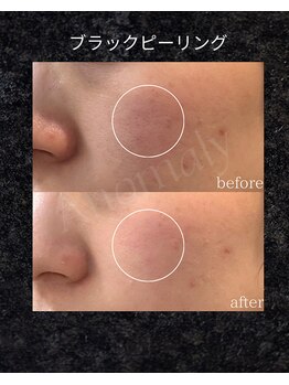 アノマリー 六本松店(Anomaly)/before → after