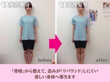ゲラン(GELAN)の雰囲気（O脚、X脚も改善します♪長年の癖づいた姿勢を正しい位置に◎）