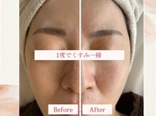 フェスティナ レンテ(Festina Lente)