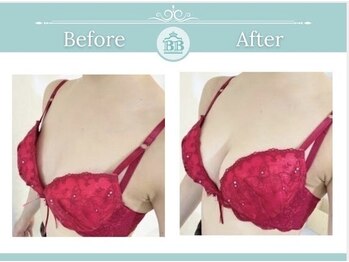 美人バスト 岡山店/バストアップ・バストケア症例★