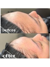 ランド(LAND)/艶肌フェイスワックス