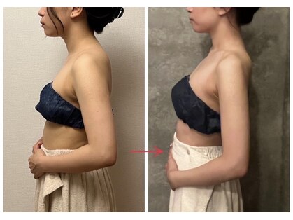 ビノワ(Binowa)の写真