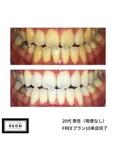 レオン 磐田(REON)/◇ お客様 before＆after ◇