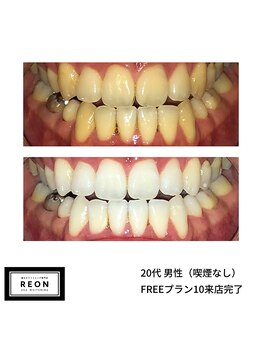 レオン 磐田(REON)/◇ お客様 before＆after ◇