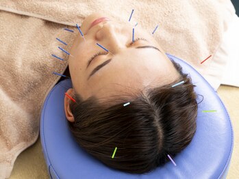 ゆり鍼灸/クセになる方続出!!"美容鍼"
