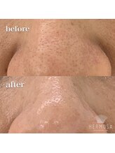 ラ ヴィレ ボーテ(La vraie beaute’)/before after