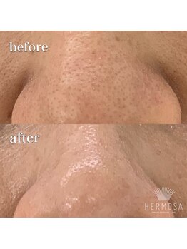 ラ ヴィレ ボーテ(La vraie beaute’)/before after