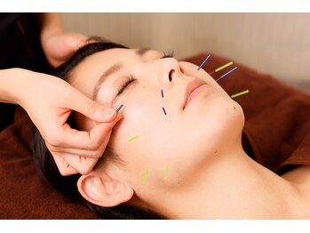 ラ コンシェル たまプラーザ店/美容鍼で自分史上最高の笑顔に！