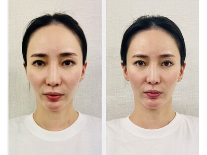 ヒミタニ(himitani.)の写真