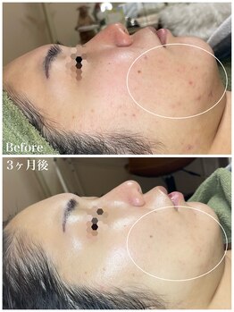 ちらちゅら/クリスティーナ