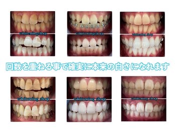 ホワイトニングショップ 刈谷店